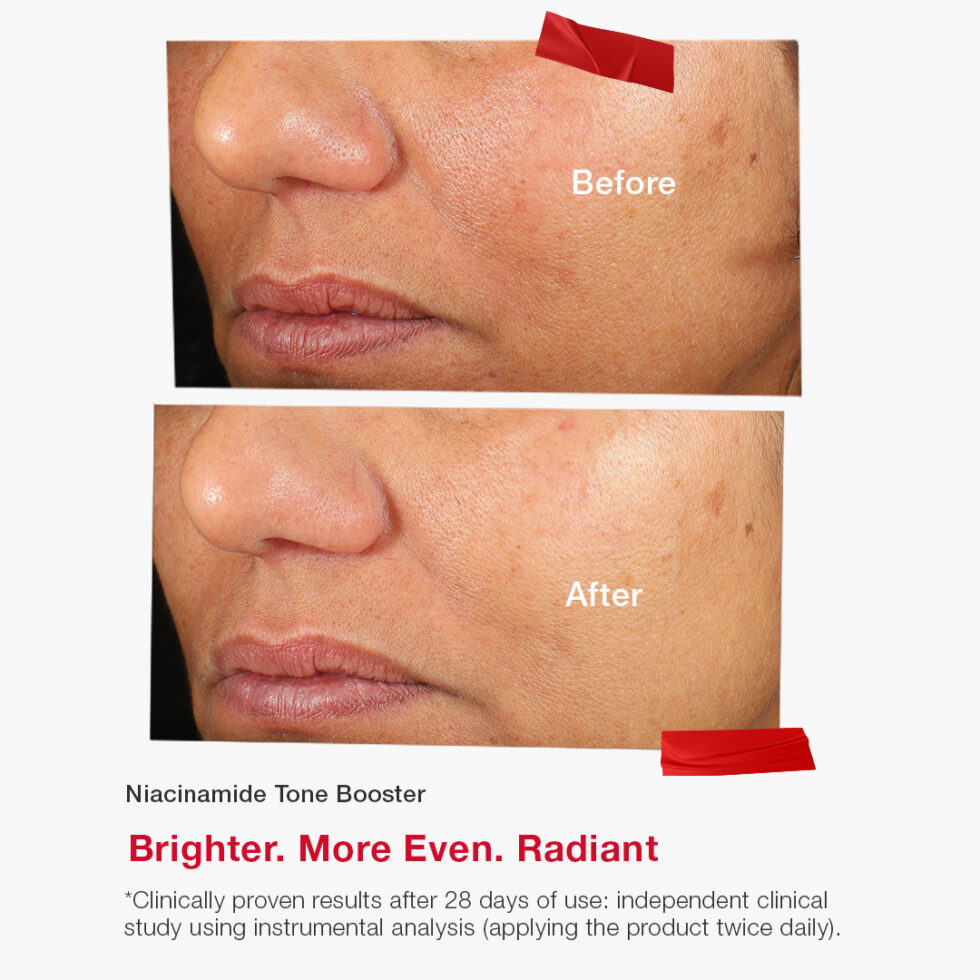 Niacinamide Tone Booster - Image 5
